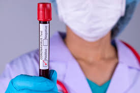 354  nuevos casos positivos y 6 fallecidos en Córdoba reportó este 4 de septiembre  